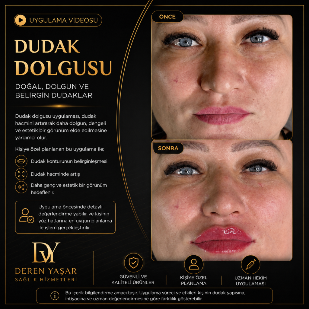 Dudak Dolgusu Uygulaması