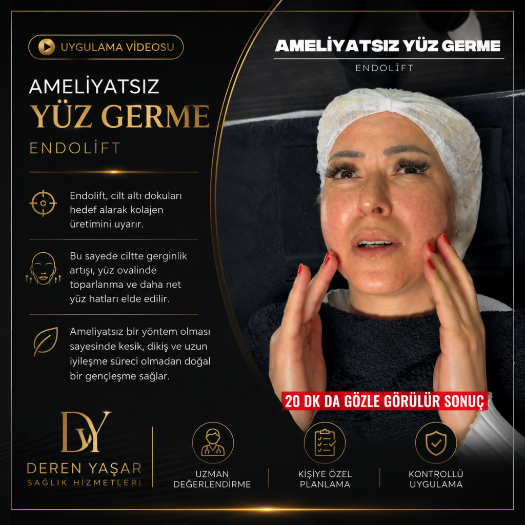 Endolift Ameliyatsız Yüz Germe Uygulaması