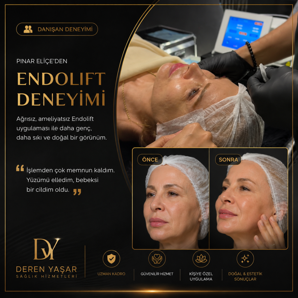 Pınar Eliçe’den Endolift Deneyimi